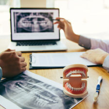 東京(外苑前)の自由診療専門歯科医院、サウラデンタルクリニックで、セカンドオピニオンについての解説
